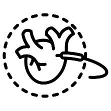 Intramyocardial Catheter